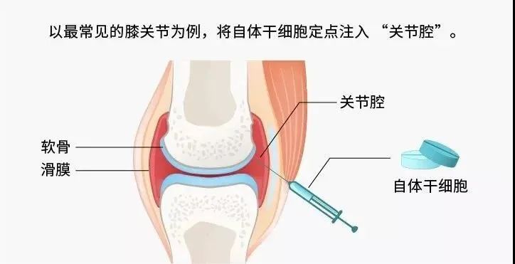 一半的致殘率！這個(gè)小毛病人人值得警惕！(圖7)