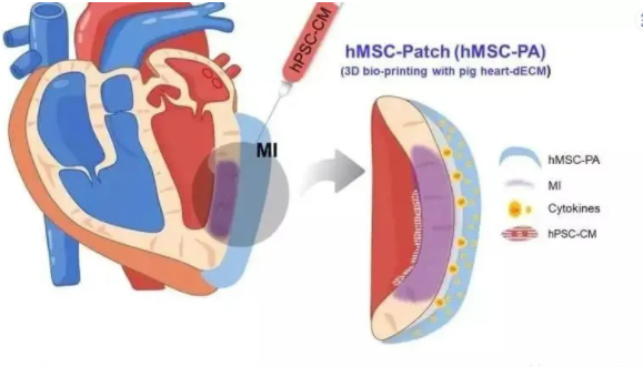 真實(shí)案例：上億個(gè)干細(xì)胞進(jìn)入心臟受損區(qū)域后，他的心臟病......(圖8)